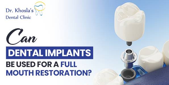 Full Mouth Restoration