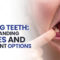 Missing Teeth: Understanding Causes and Treatment options