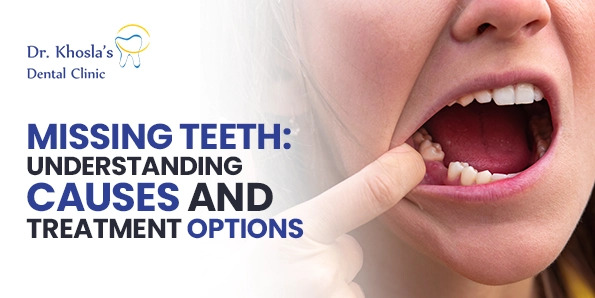 Missing Teeth: Understanding Causes and Treatment options