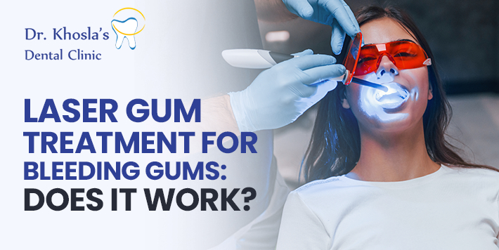 Laser Gum Treatment