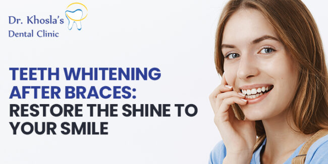 Teeth Whitening After Braces