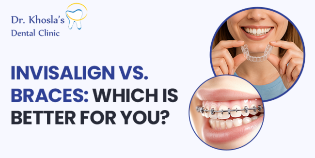 Invisalign vs Braces