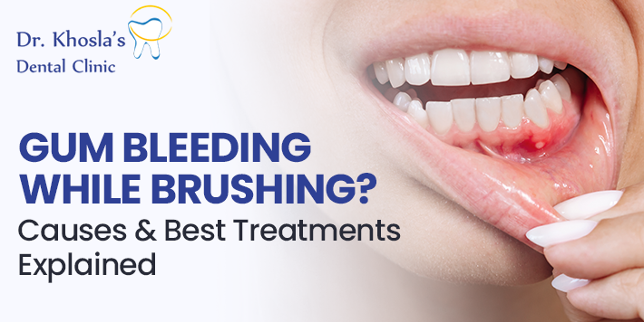 gum bleeding causes treatment